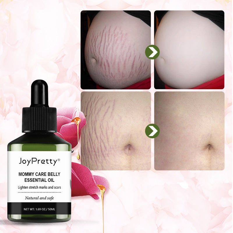 Reduce Postpartum Obesity And Stretch Marks Repair Essential Oil